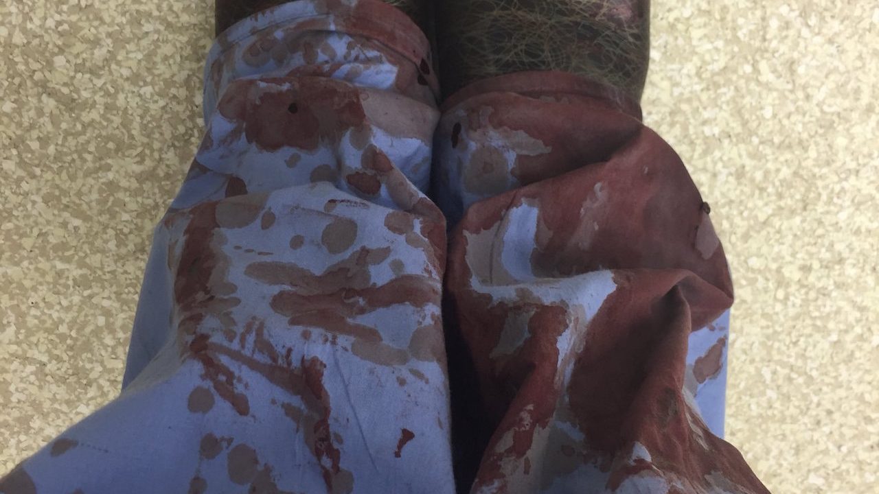 1 millón de estadounidenses morirán en la siguiente década por impacto de bala