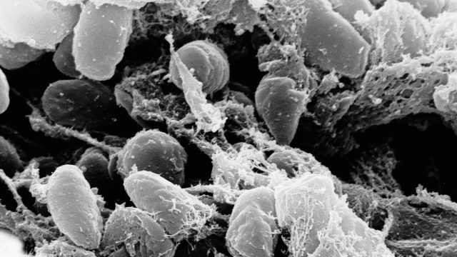 14/11/19, Peste Negra, Peste Pulmonar, China, Enfermedad