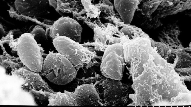 En Mongolia hay brotes de peste bubónica, En la región china de Mongolia se presentó un presunto caso de peste bubónica