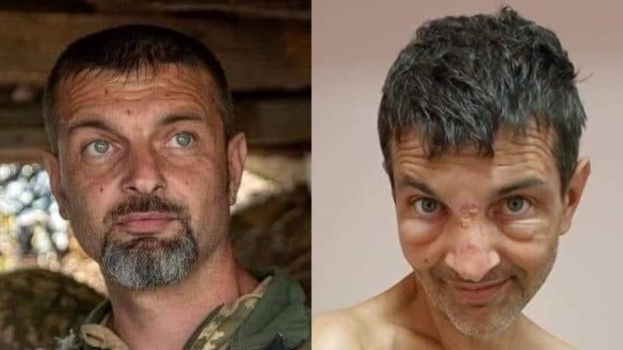 Antes y después: Revelan fotos de un soldado ucraniano que sobrevivió a un secuestro por rusos