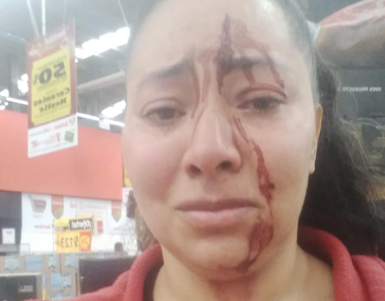 Agreden a mujer en supermercado de CDMX y policía le dice que "se fuera con su golpe"