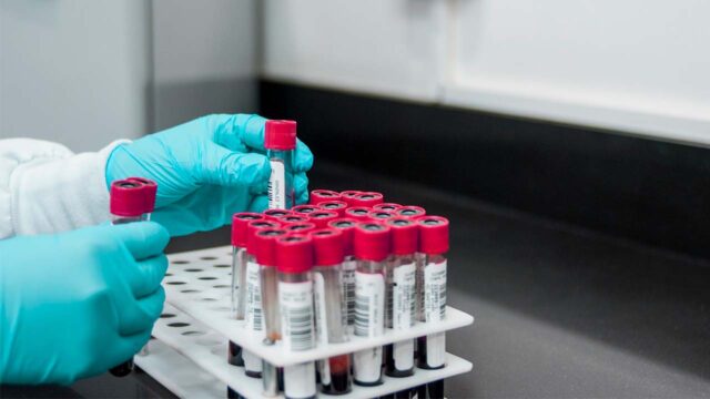 Un tercer paciente se cura de la infección por VIH tras un trasplante de células madre