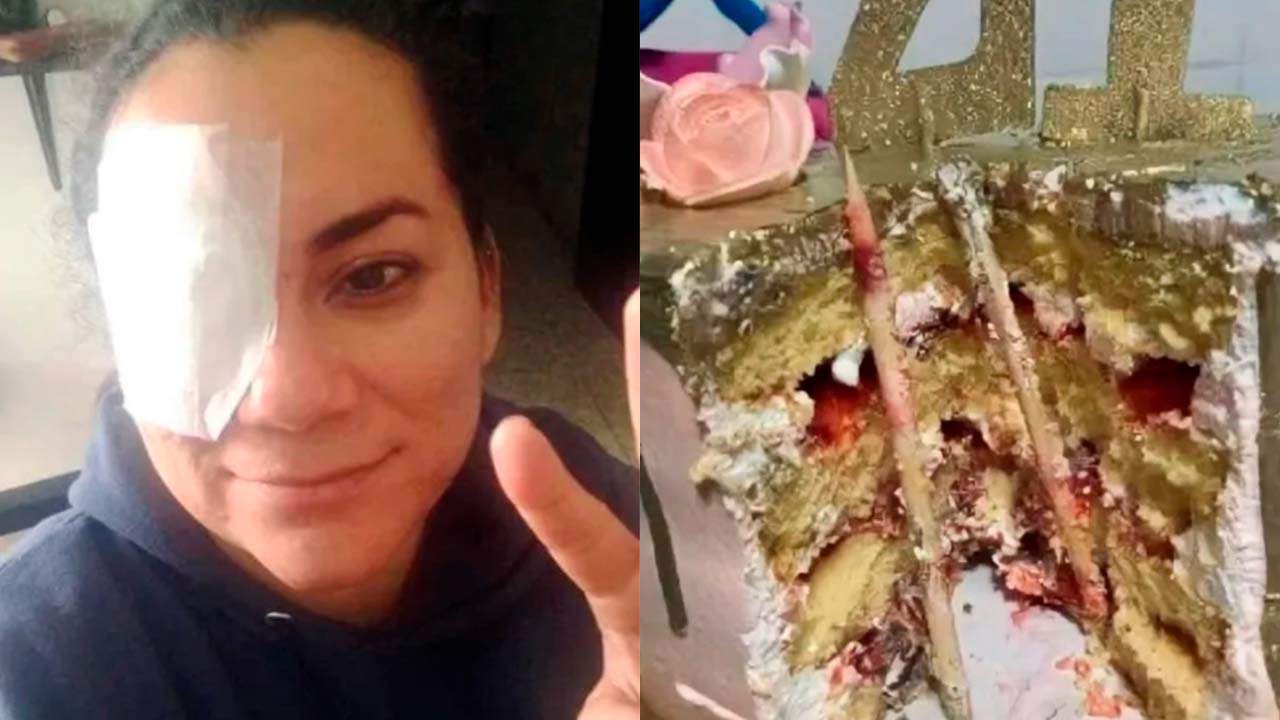 Mujer que fue aventada a su pastel de cumpleaños casi pierde un ojo: “Dejen de hacer eso”