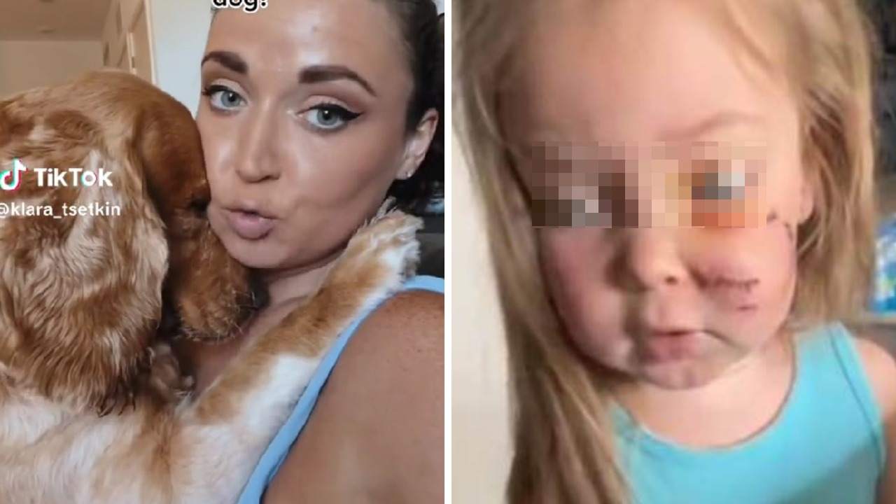 Mamá se niega a sacar a su perro pese a que mordió a su hija; video genera debate